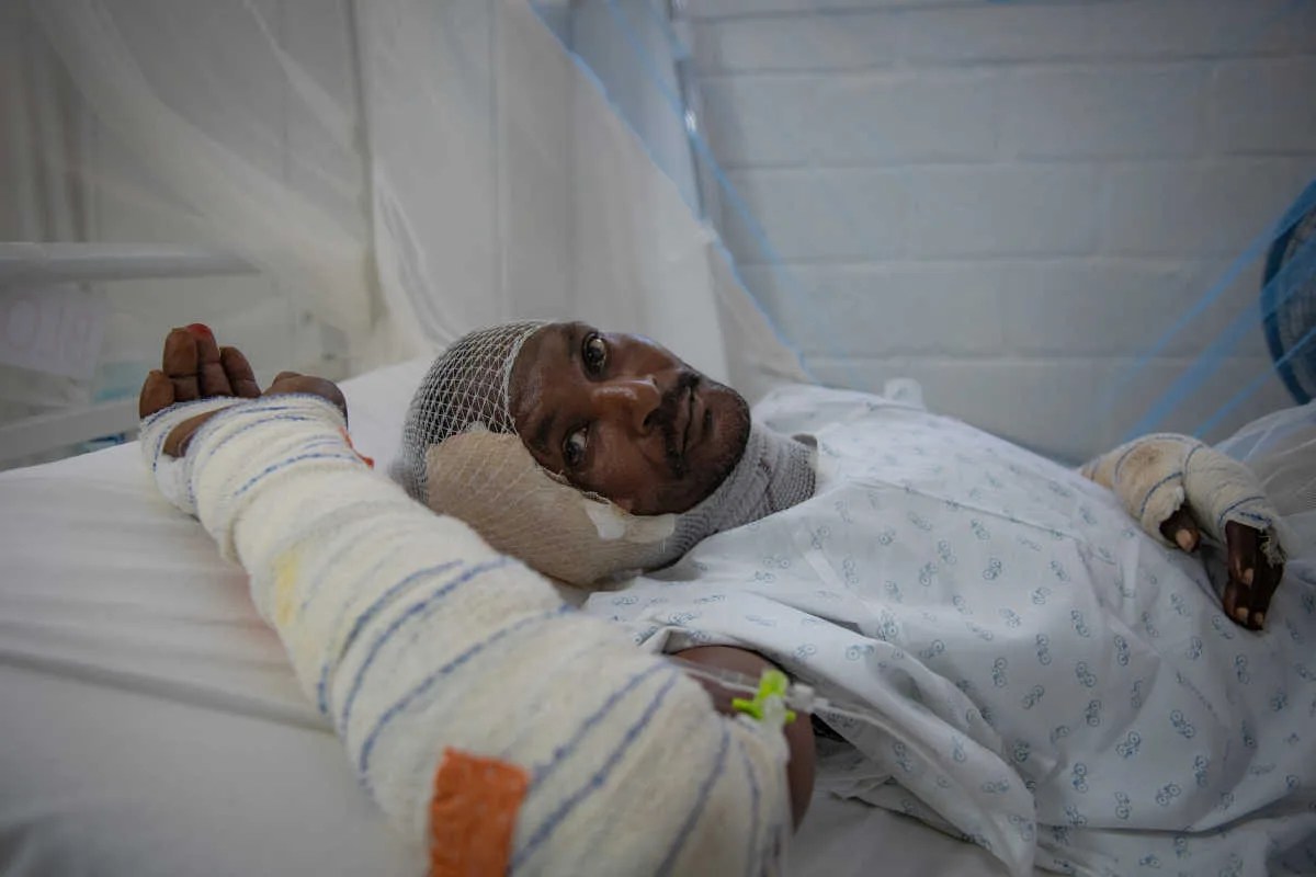 Un hombre víctima de la explosión de un camión cisterna