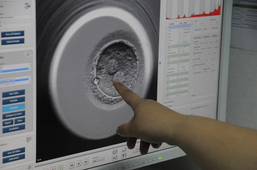 Imagen de archivo de la evolución de un embrión