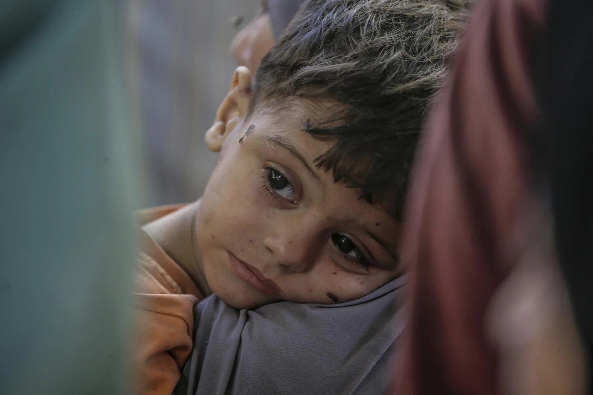 (File) A child at Al Shifa Hospital in Gaza, September 3, 2025. EFE/EPA/MOHAMMED SABER