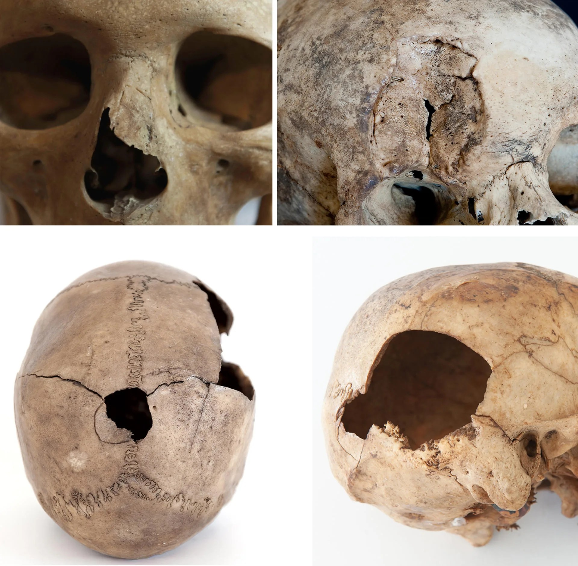 Cuatro cráneos con traumatismos, pertenecientes a la colección de El Museo Canario. EFE/El Museo Canario