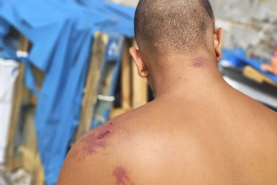 La ONG Amnistía Internacional ha denunciado torturas y vejaciones por parte de miembros de las fuerzas armadas españolas a los migrantes que permanecen en Ceuta tras la entrada masiva de finales de julio, 