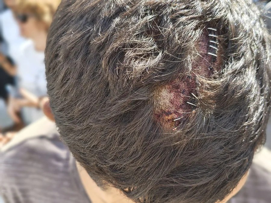 La ONG Amnistía Internacional ha denunciado torturas y vejaciones por parte de miembros de las fuerzas armadas
