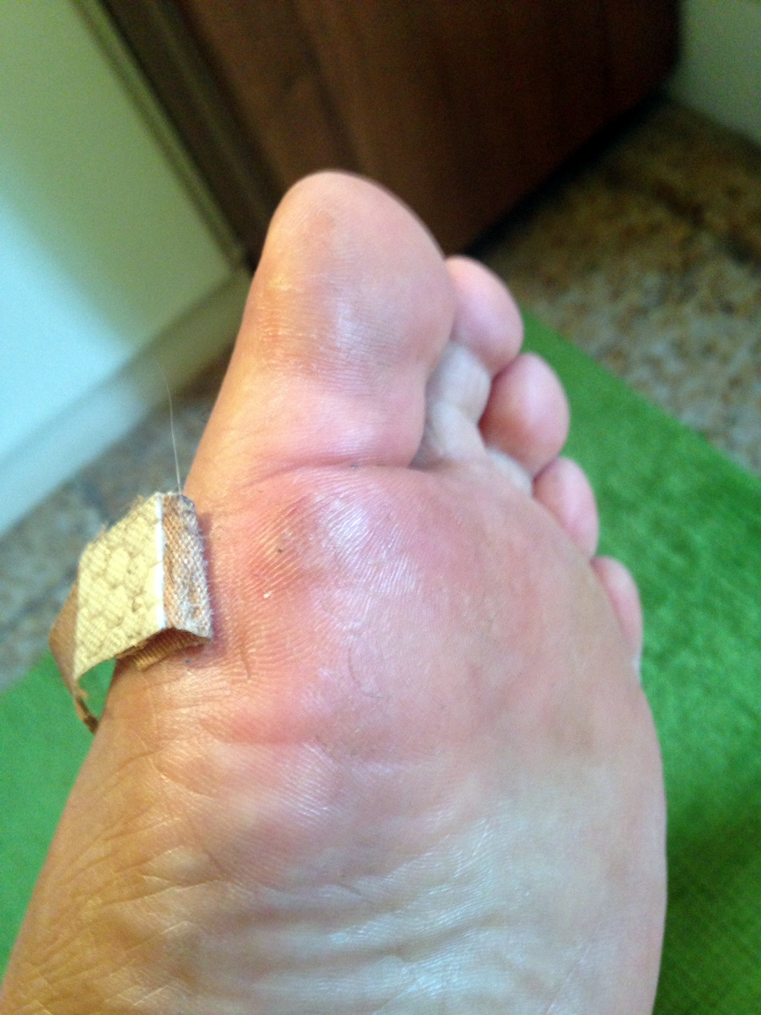 Florence toe