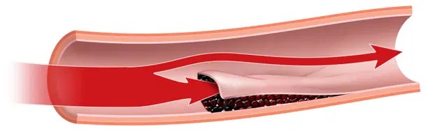 Scad Card Scad - Premium Nature Illustration Gallery - Retina