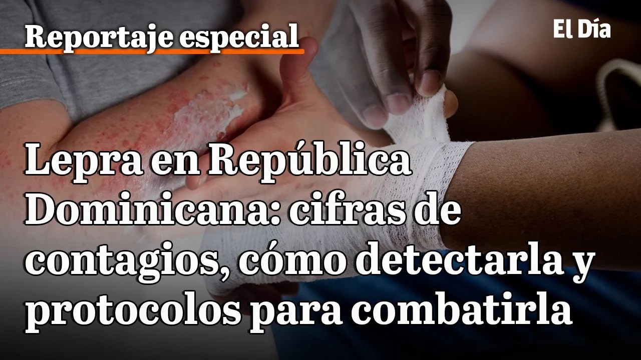 cifras de contagios y cómo detectarla