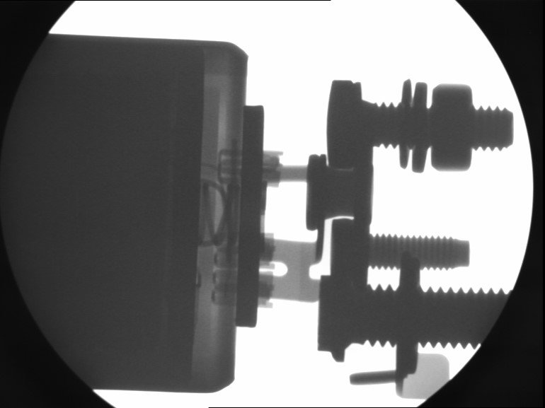 x-ray inspection of a motor