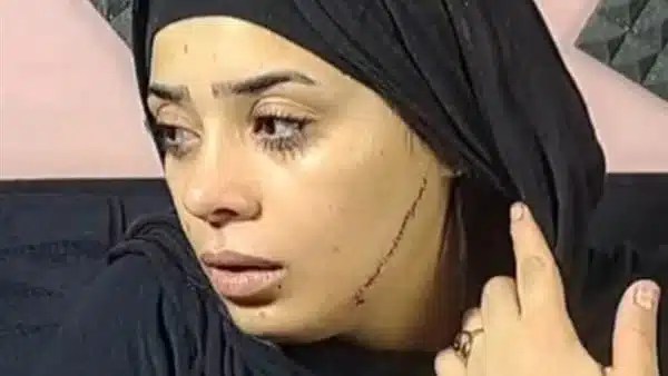 تفاصيل محاكمة المتهمة بتشويه عروس بمصر القديمة