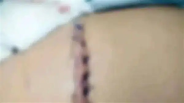 اعتداء طلاب على زميل بمدرسة بالزقازيق ومطالبة بالتحقيق