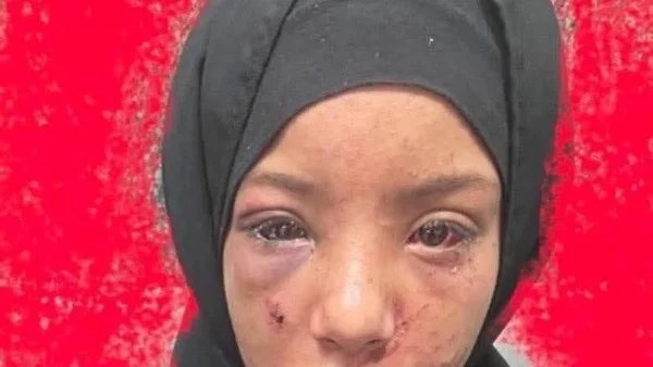 اعتداء على طفلة في الشرقية يكشف ضعف حماية الأطفال