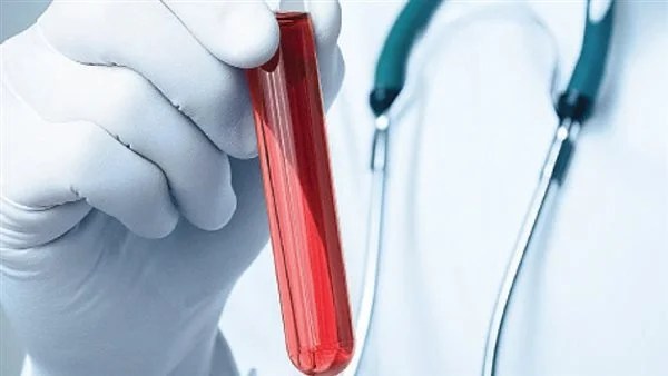 أطعمة قد تؤثر على فعالية أدوية السيولة الدموية