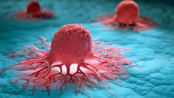 المكملات الغذائية ودورها في تقليل نمو الأورام السرطانية