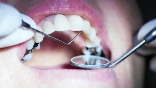 أزمة التكليف لأطباء الأسنان والقطاعات الطبية الأخرى