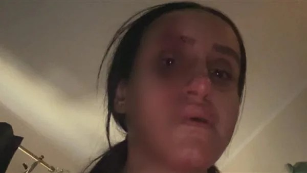 الحبس شهرين وغرامة لمتهم بالاعتداء على زوجته في بشتيل