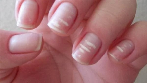 حكم قص الأظافر ليلاً في الشريعة الإسلامية