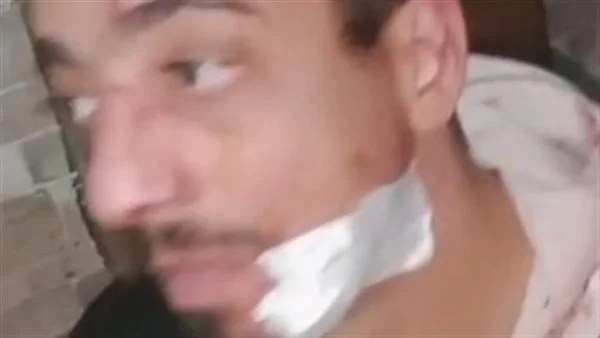 اعتداء على بائع أحذية في جسر السويس