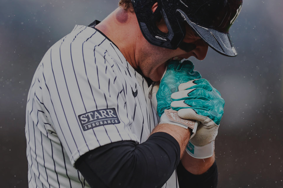 ¡no otra vez! Anthony rizzo tiene un dedo fracturado y podría perderse los playoffs