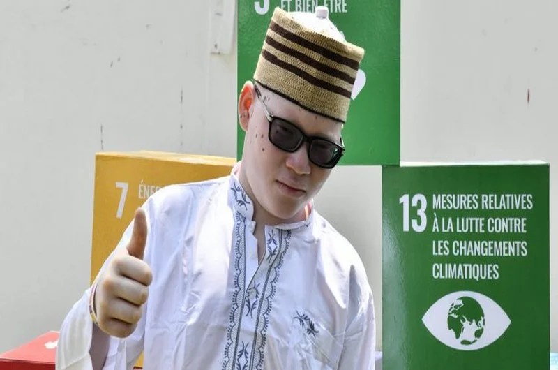 Le PNUD offre des verres médicaux à 35 albinos souffrant de déficience visuelle