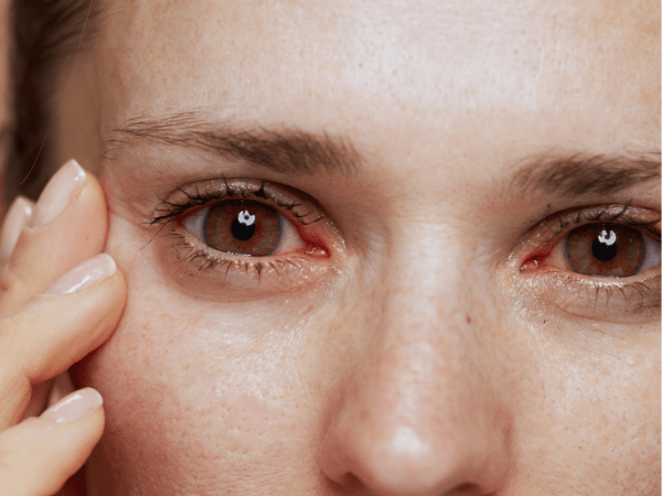 The Link Between Hydration and Healthy Eyes 2