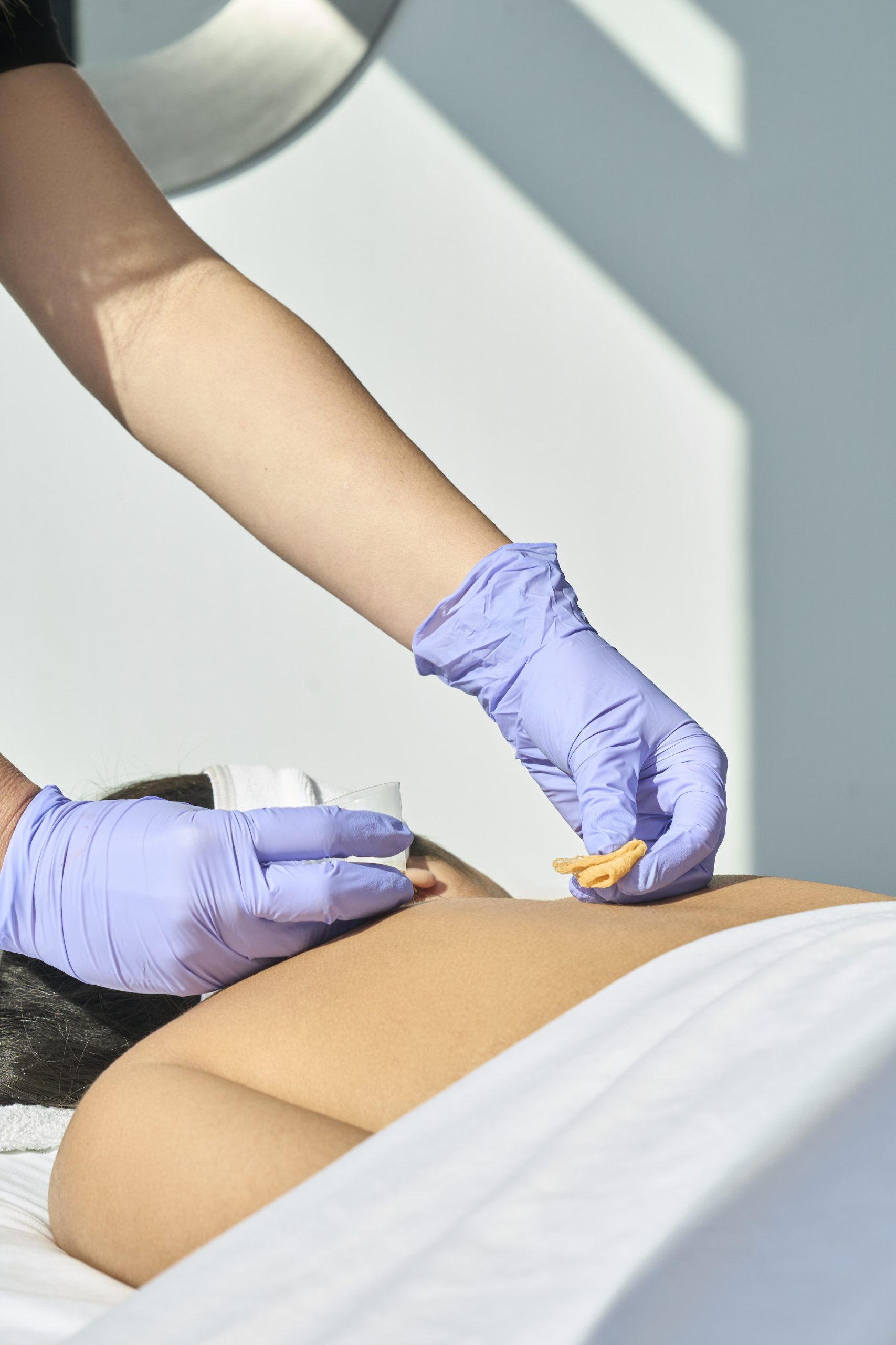 Back Peel