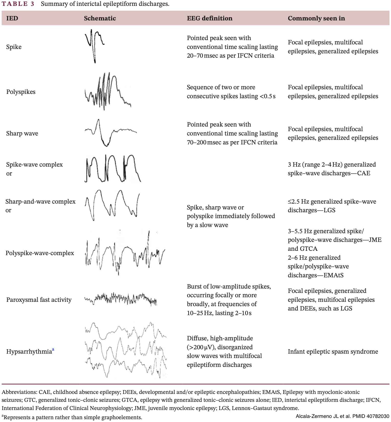 EEG interpretation and ictal-interictal continuum - EMCrit Project