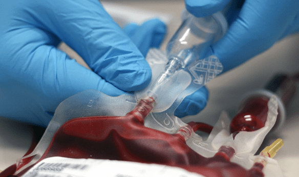 Μετάγγιση Αίματος και Παραγώγων