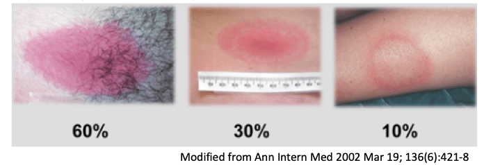 The covid pandemic and getting older can diminish your ability to recognize faces. Vector-Borne Illness: Lyme disease and Malaria - EMOttawa