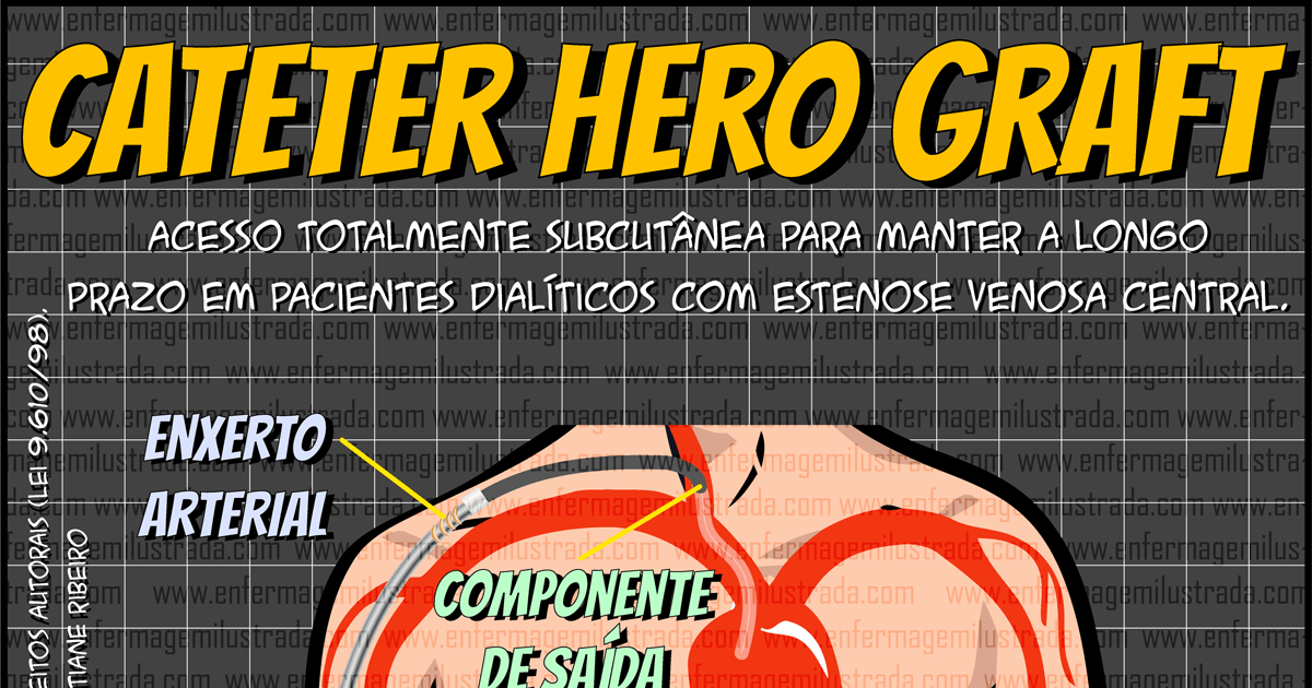 Cateter HeRO® Graft