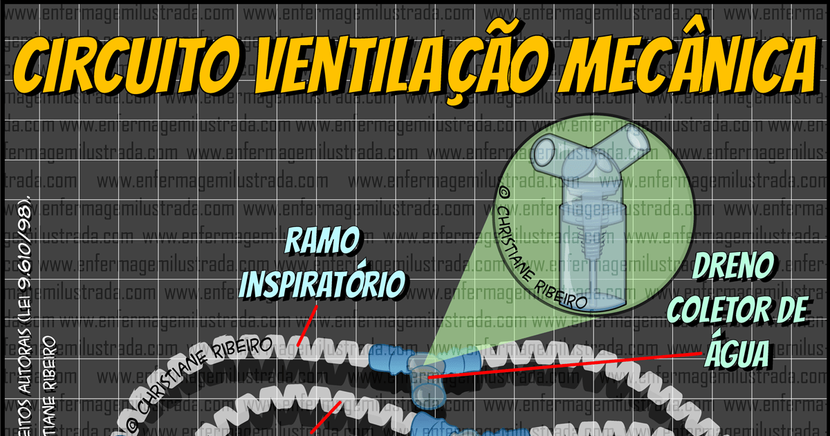 Circuito para Ventilação Mecânica: Entenda sua Função!