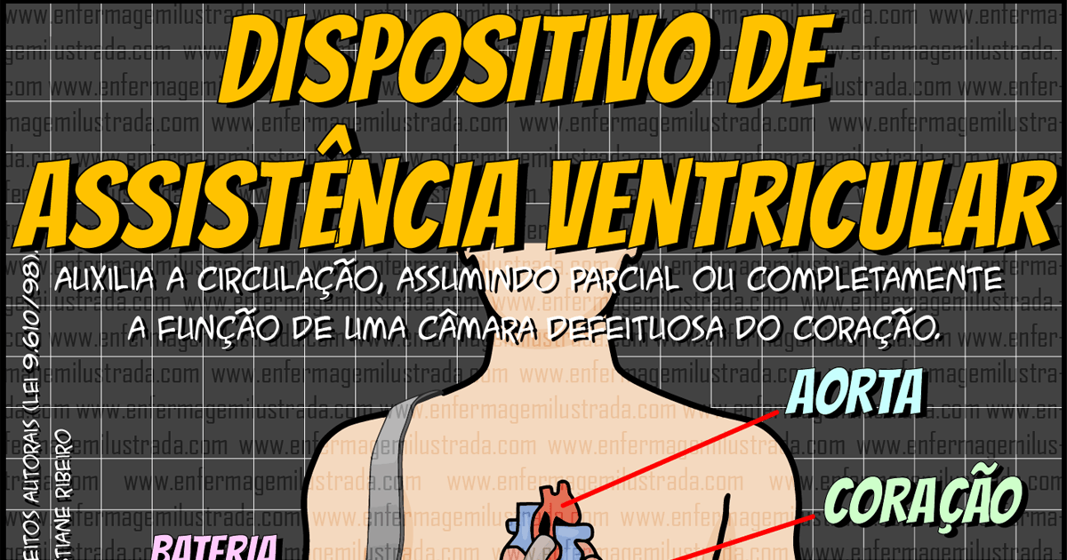 Dispositivo de Assistência Ventricular (VAD)
