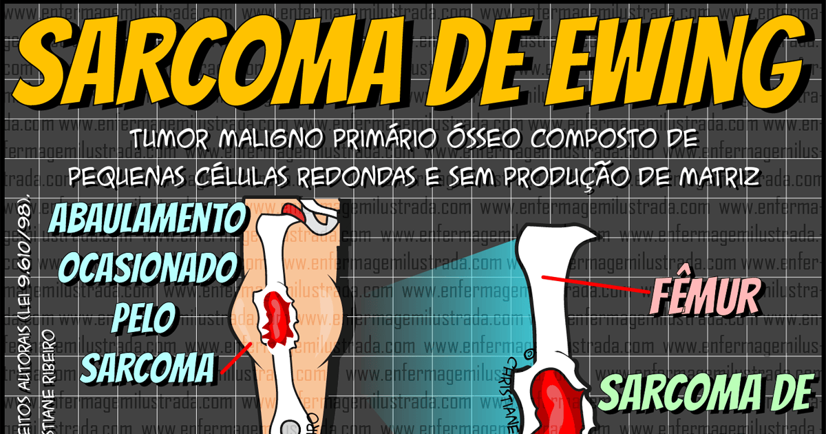 Sarcoma de Ewing