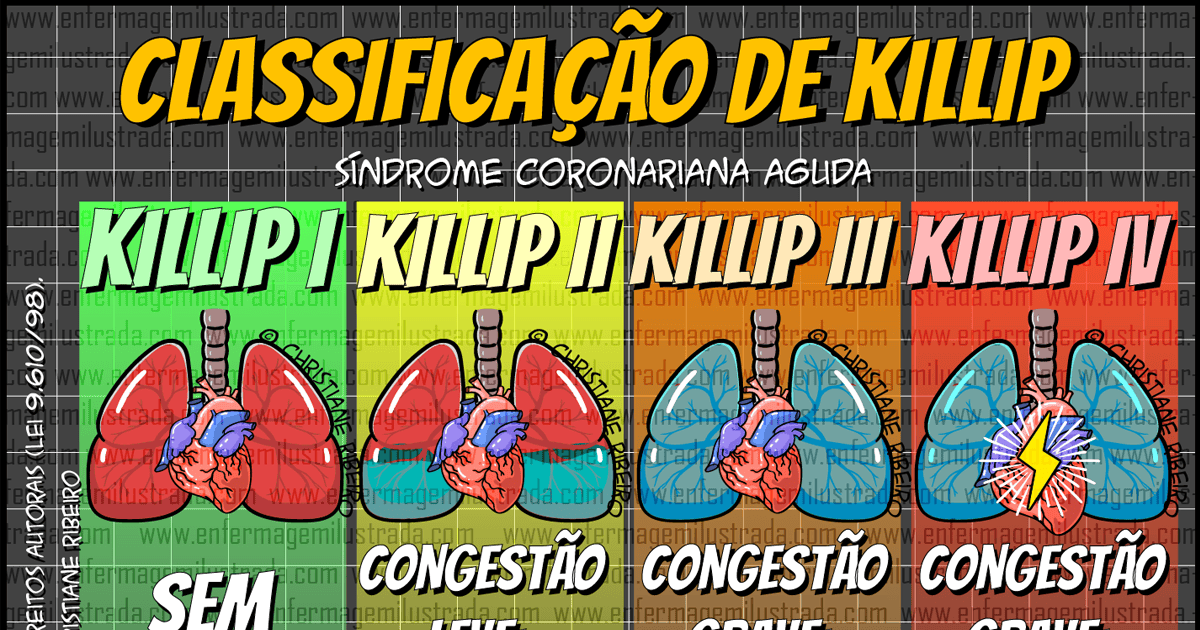 Classificação de Killip na SCA
