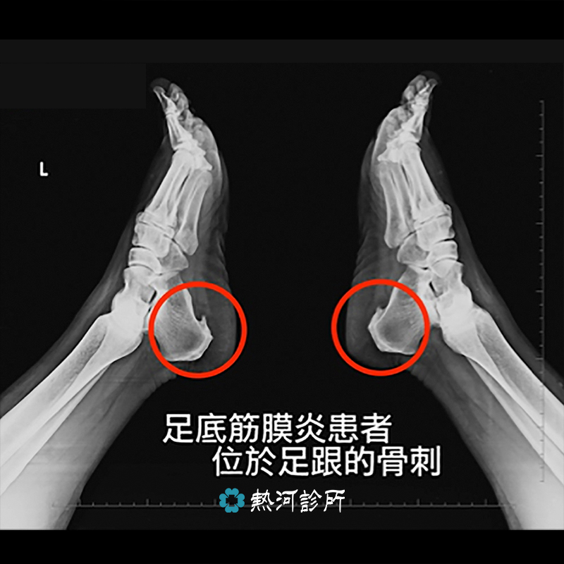 膝蓋痛看中醫還是西醫請問ㄧ下 膝蓋有擦傷 要看中醫還是西醫呢 順便要申請診斷證明 Lvai
