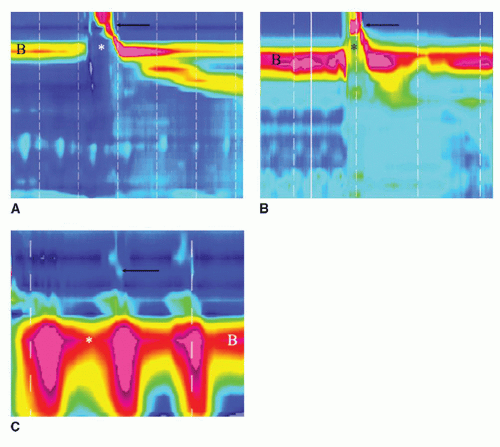 Functional Assessment of Swallowing | Ento Key