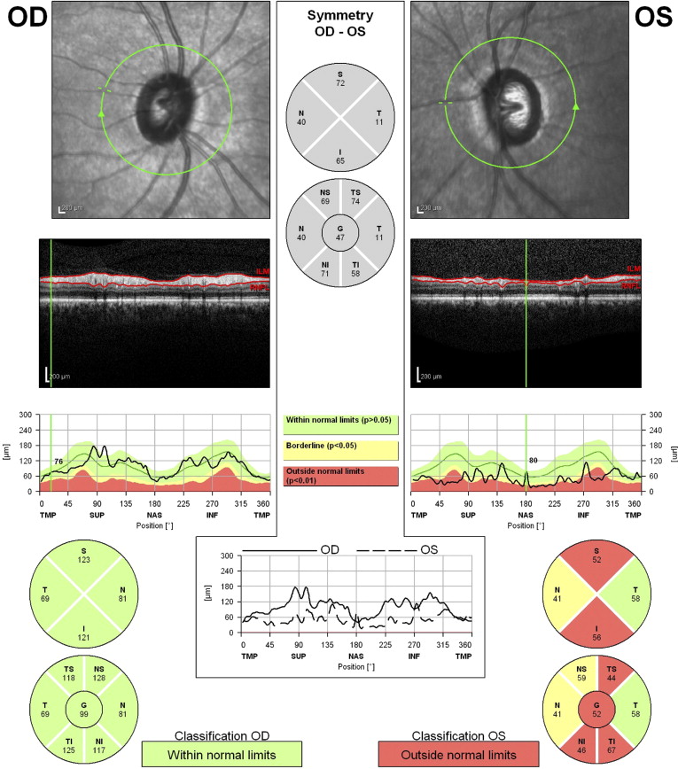 Diagnostic Capability of Spectral-Domain Optical Coherence