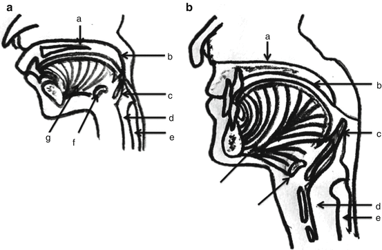 Anatomy of Swallowing | Ento Key