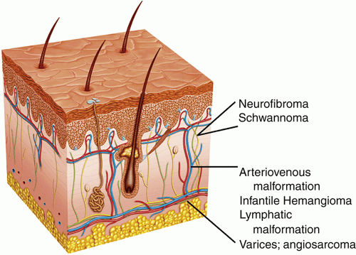 Eyelid Lesions and Their Origin in Eyelid Tissues | Ento Key