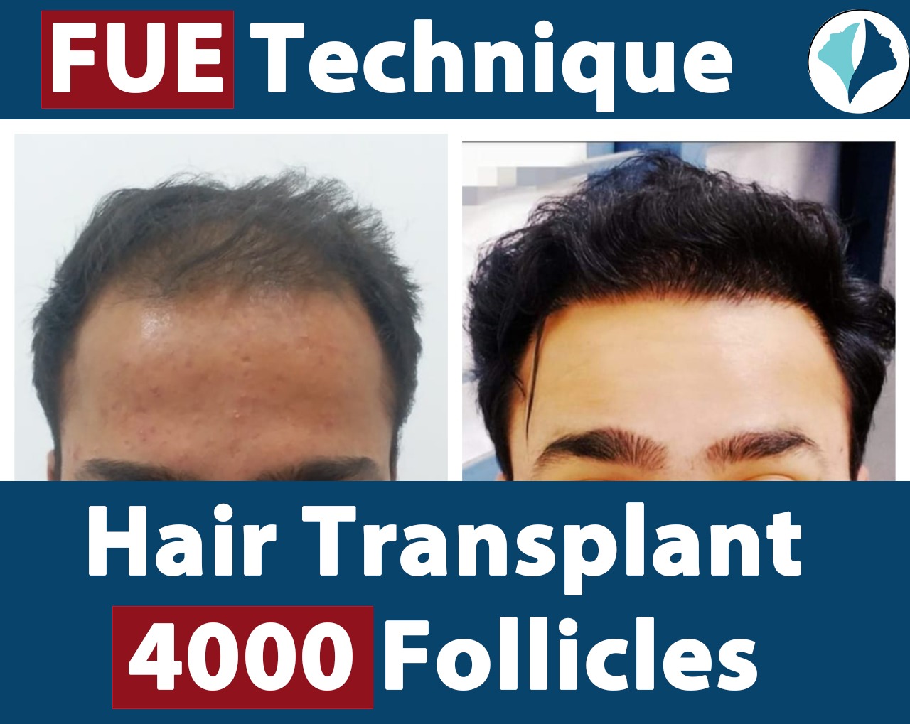 Results Essence Cosmetic Surgery Clinic