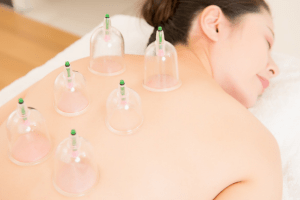 Cupping