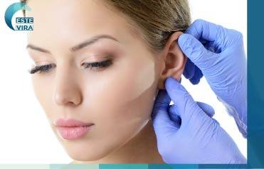 تجميل الاذنين