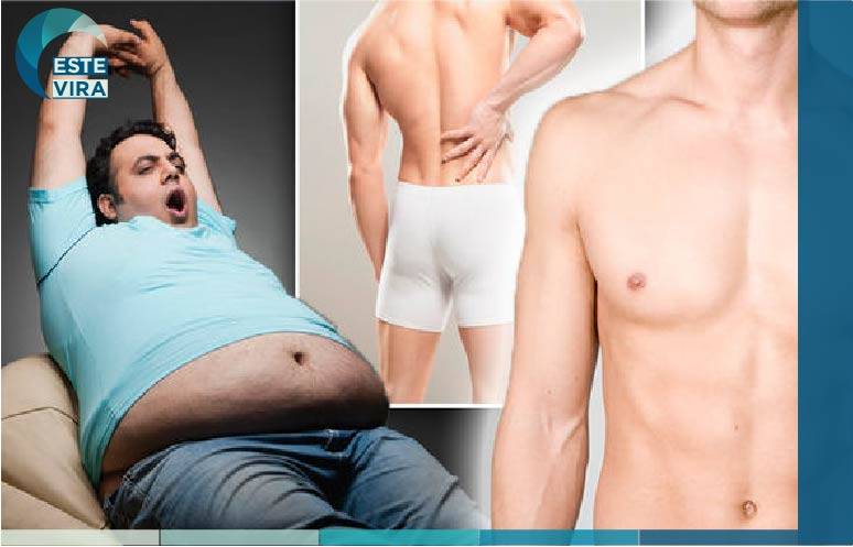 قص و تكميم المعدة