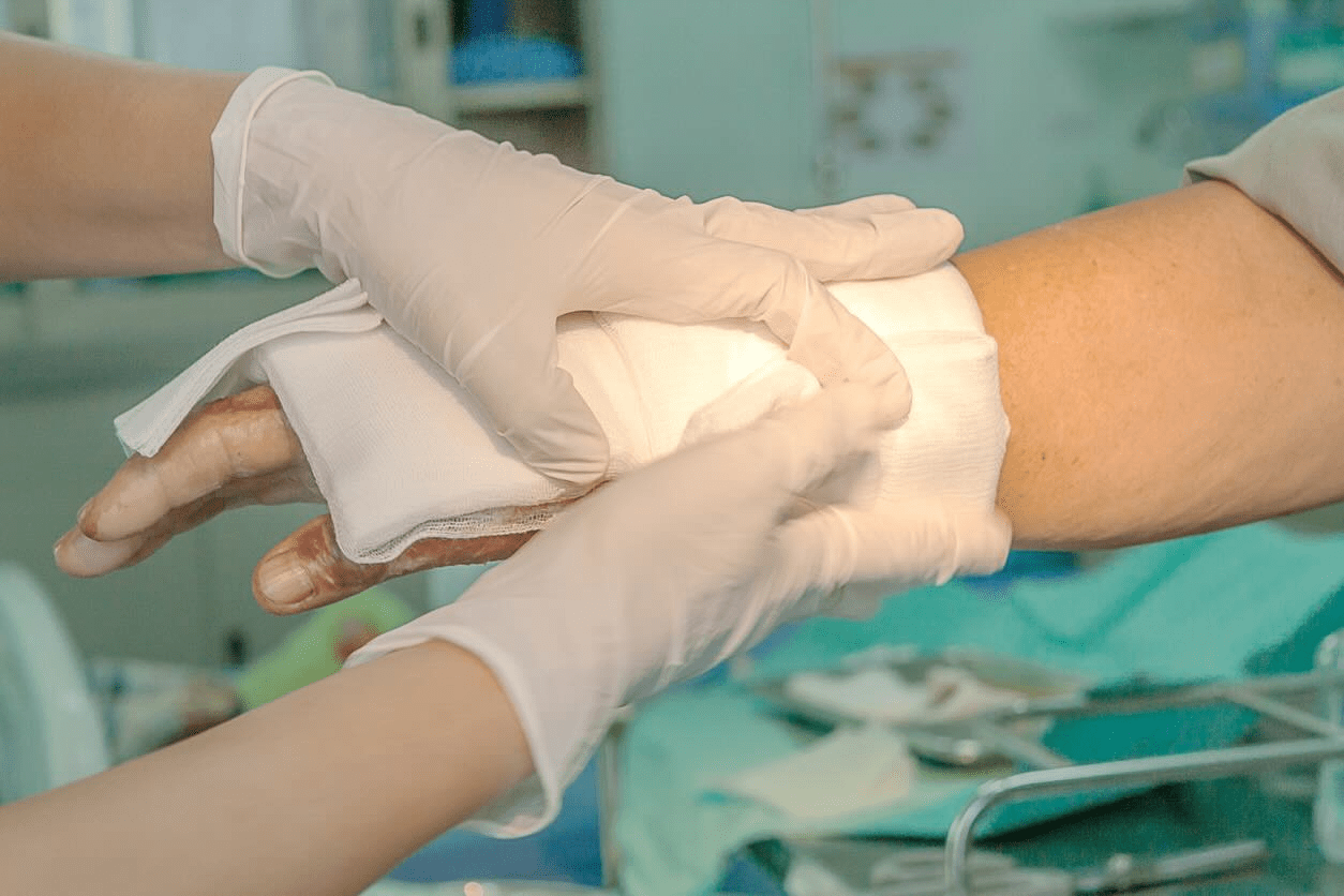 Dressing burned wound hand with gauze pad iamge