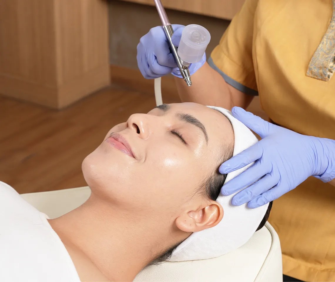 Treatment Menghilangkan Bekas Jerawat yang Tepat dan Aman untuk Kulit Kamu