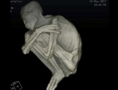 A Refutation of the Alleged Three Finger Nazca Humanoid “Mummies”