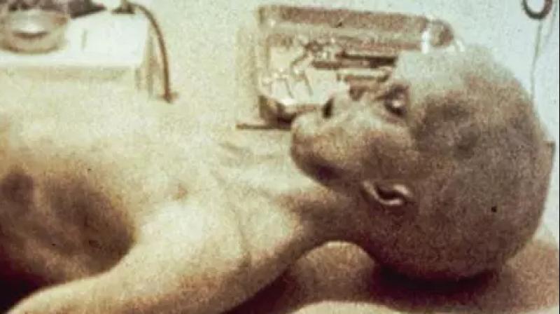 CIA Bribed UK Musician to Hide Facts About Alien Autopsy, Claims Researcher