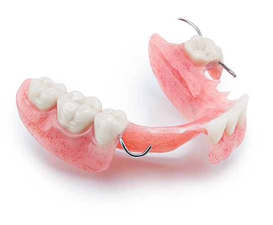 dental bridge denture