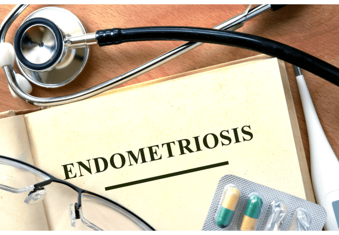 Endometriosis