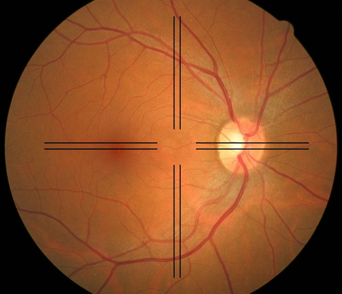 Adjusting the Eyepiece Reticle | EYE-PIX