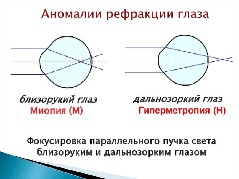 Улучшаем зрение народными средствами: питание, рецепты, упражнения. Как эффективно улучшить зрение Как поднять зрение в домашних условиях