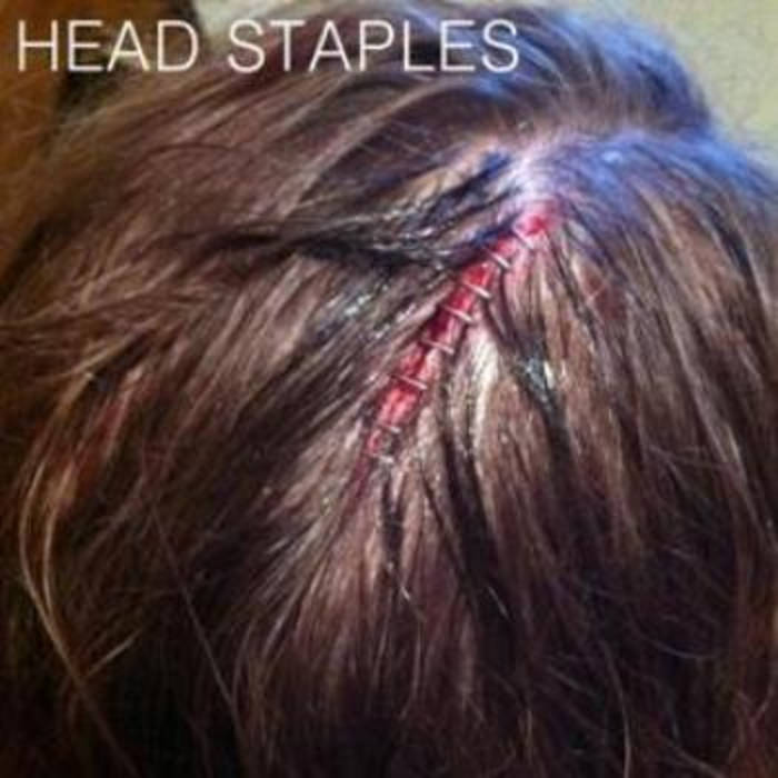 photo Staples In Head watermelon