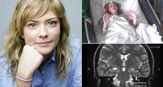 Autoimmune disease
